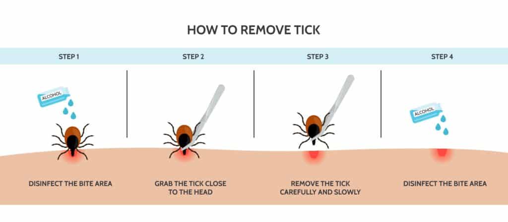 How To Remove a Tick